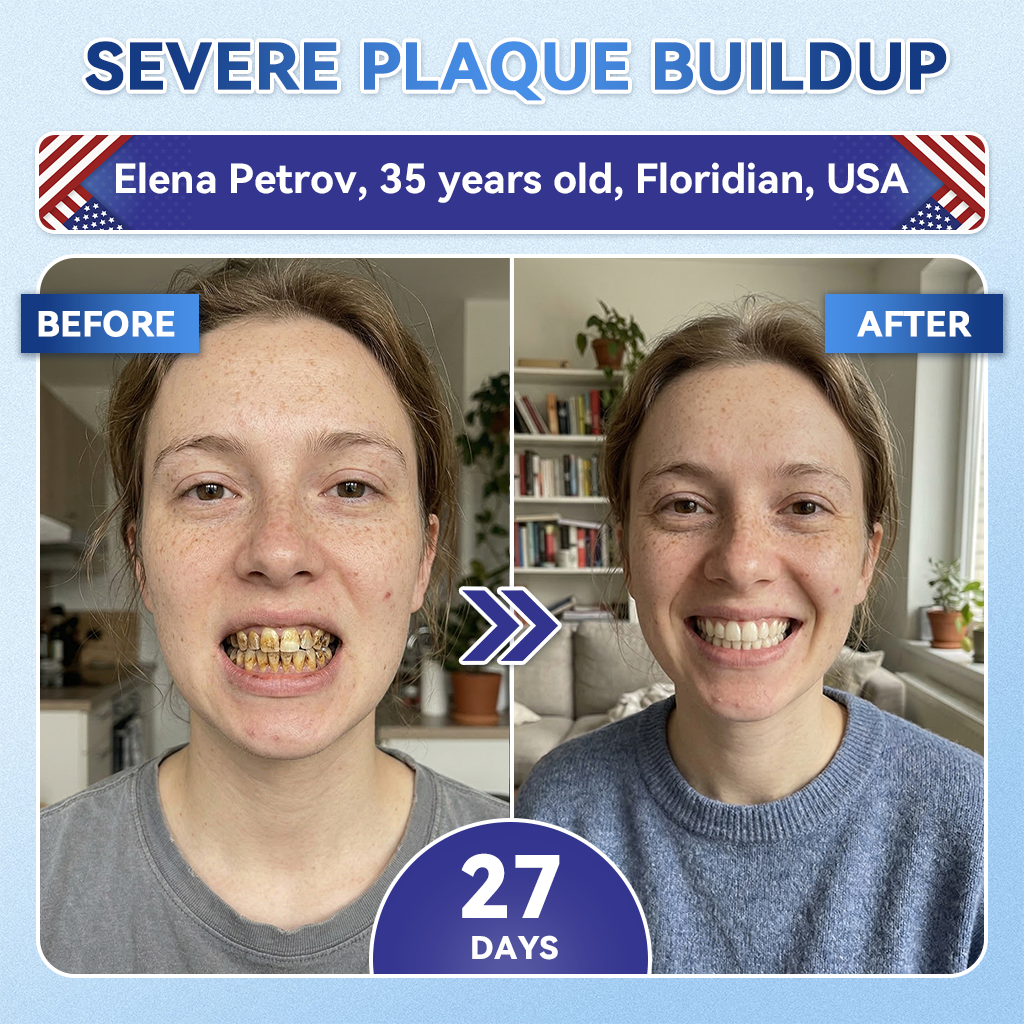 🔥LAST DAY SALE 49% OFF--OnlyJoy™ 🦷 Tideglusib Fast‑Dissolving Tooth & Gum Repair Oral Strips ✨