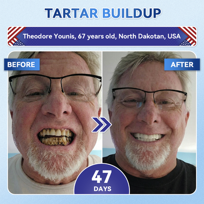 🔥LAST DAY SALE 49% OFF--OnlyJoy™ 🦷 Tideglusib Fast‑Dissolving Tooth & Gum Repair Oral Strips ✨