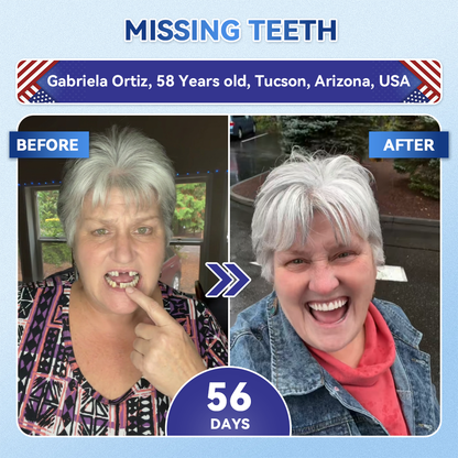 🔥LAST DAY SALE 49% OFF--OnlyJoy™ 🦷 Tideglusib Fast‑Dissolving Tooth & Gum Repair Oral Strips ✨