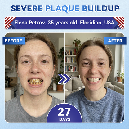 🔥LAST DAY SALE 49% OFF--OnlyJoy™ 🦷 Tideglusib Fast‑Dissolving Tooth & Gum Repair Oral Strips ✨